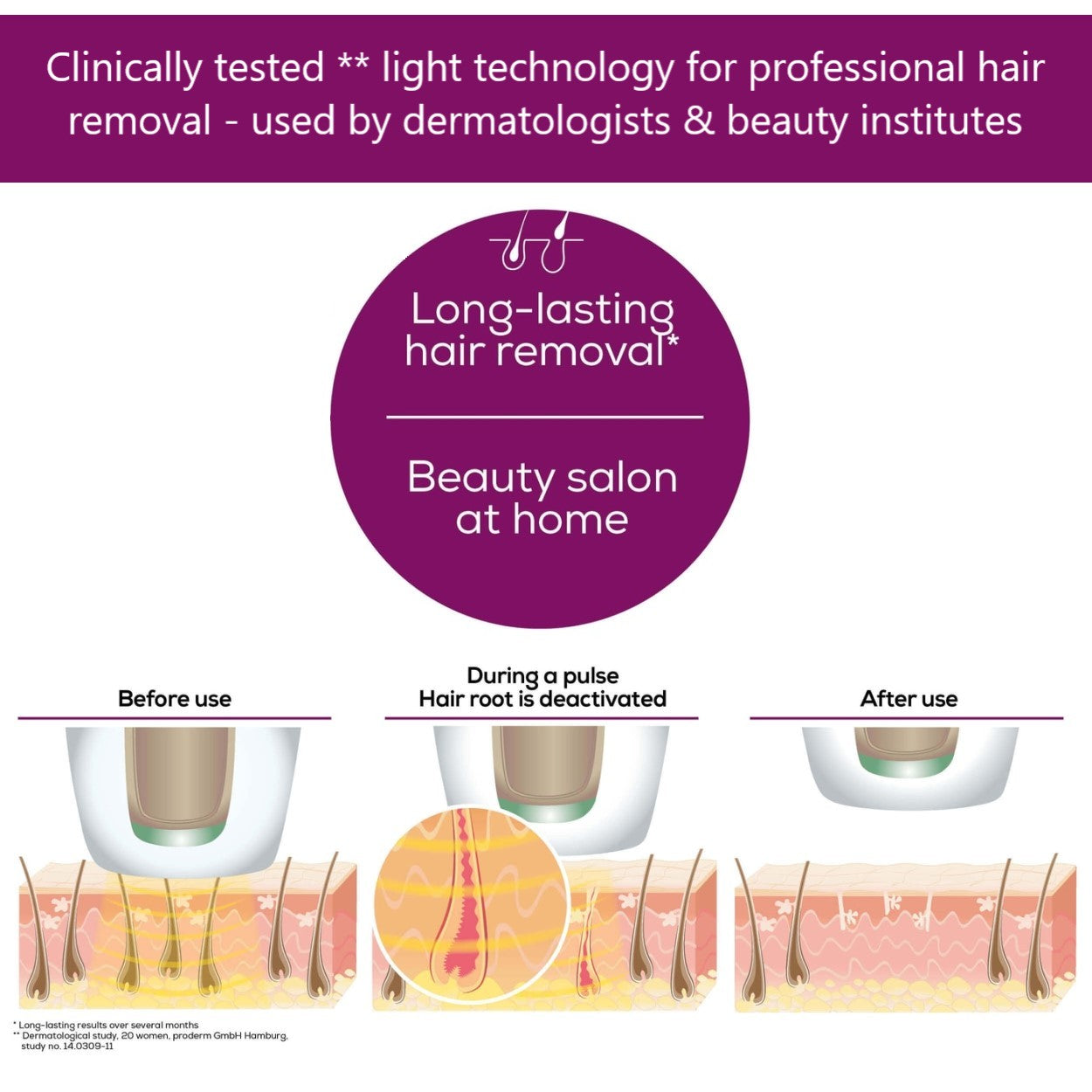 Beurer IPL 10000+ Salonpro System Long Lasting Laser Hair Removal Device for Face & Body