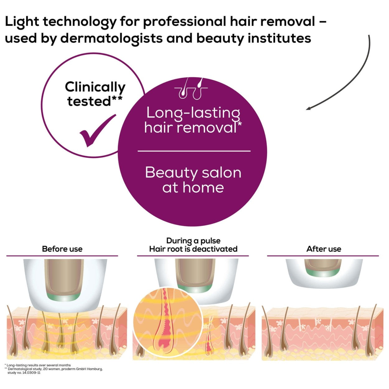Beurer Cordless IPL Laser Device: Long Lasting Hair Removal for Face & Body - IPL 8500 Velvet Skin Pro