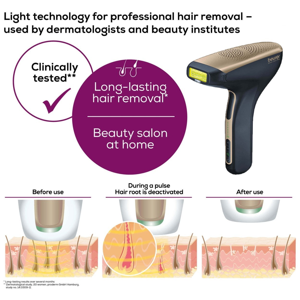 Beurer IPL Laser Hair Removal Device: Cordless IPL 8800+App for Face & Body